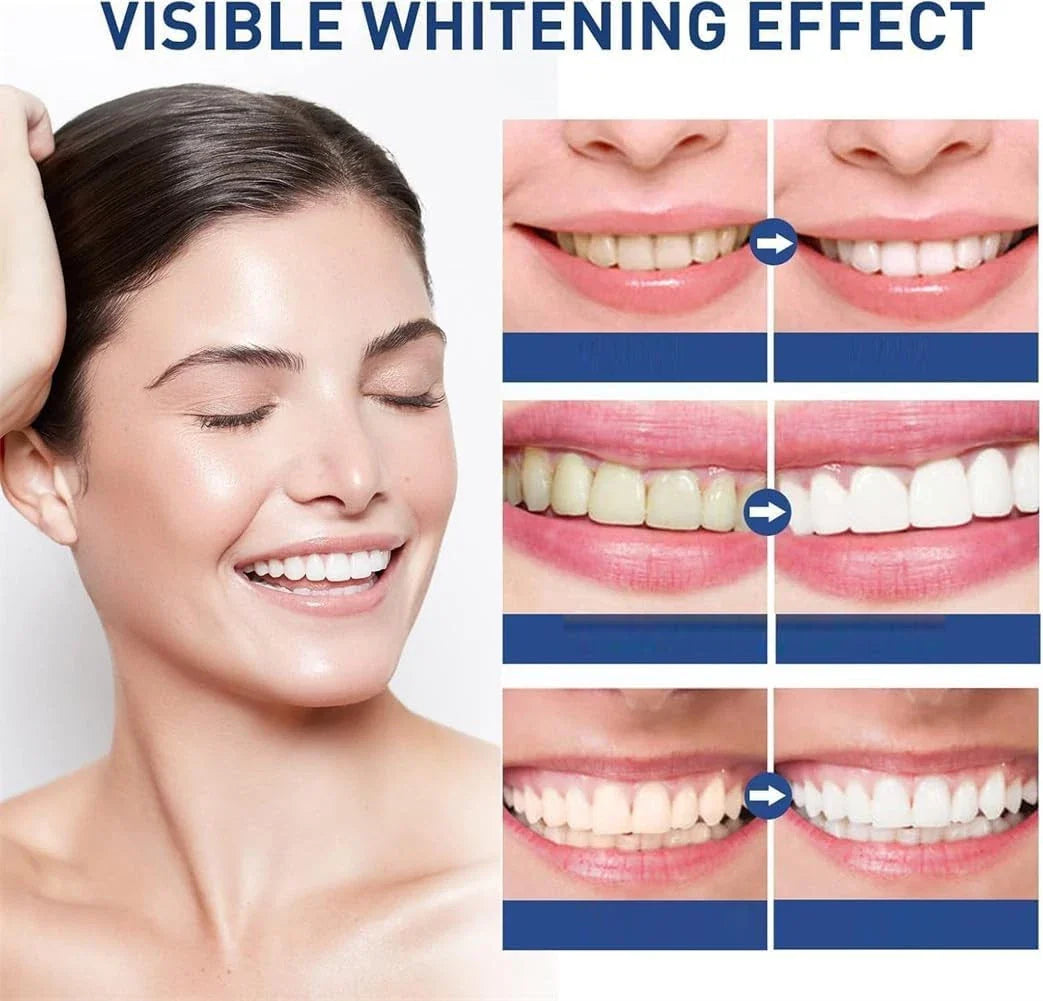 LumiSmile — Achieve Professional Whiteness Instantly + 50% OFF
