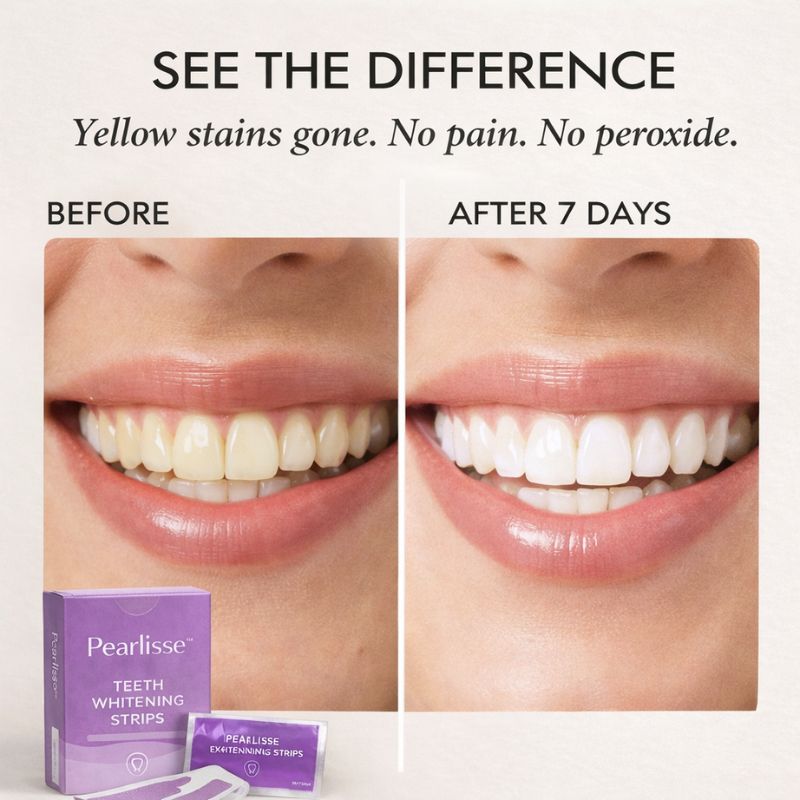 Pearlisse™ – PAP+ Peroxide-Free Teeth Whitening Strips + 50% OFF