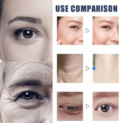 DermalDeep - Fill Deep Wrinkles Instantly + 50% OFF