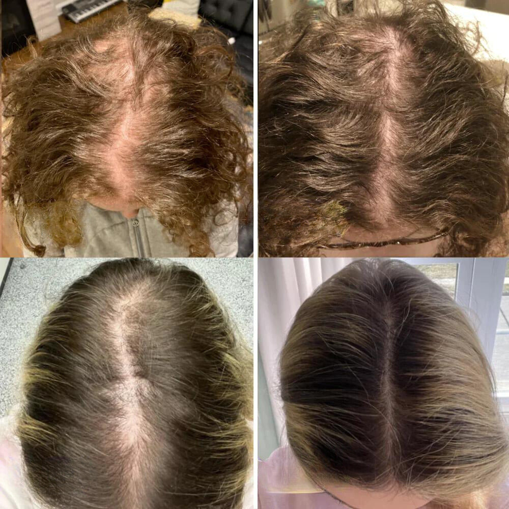 The EELHOE Natural Growth Oil - Rosemary, Castor, and Green Coffee for Thicker, Fuller Hair +  50% OFF