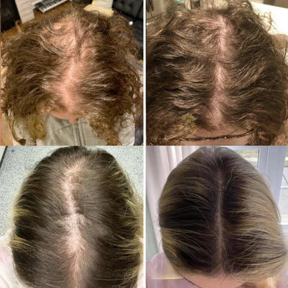 The EELHOE Natural Growth Oil - Rosemary, Castor, and Green Coffee for Thicker, Fuller Hair +  50% OFF