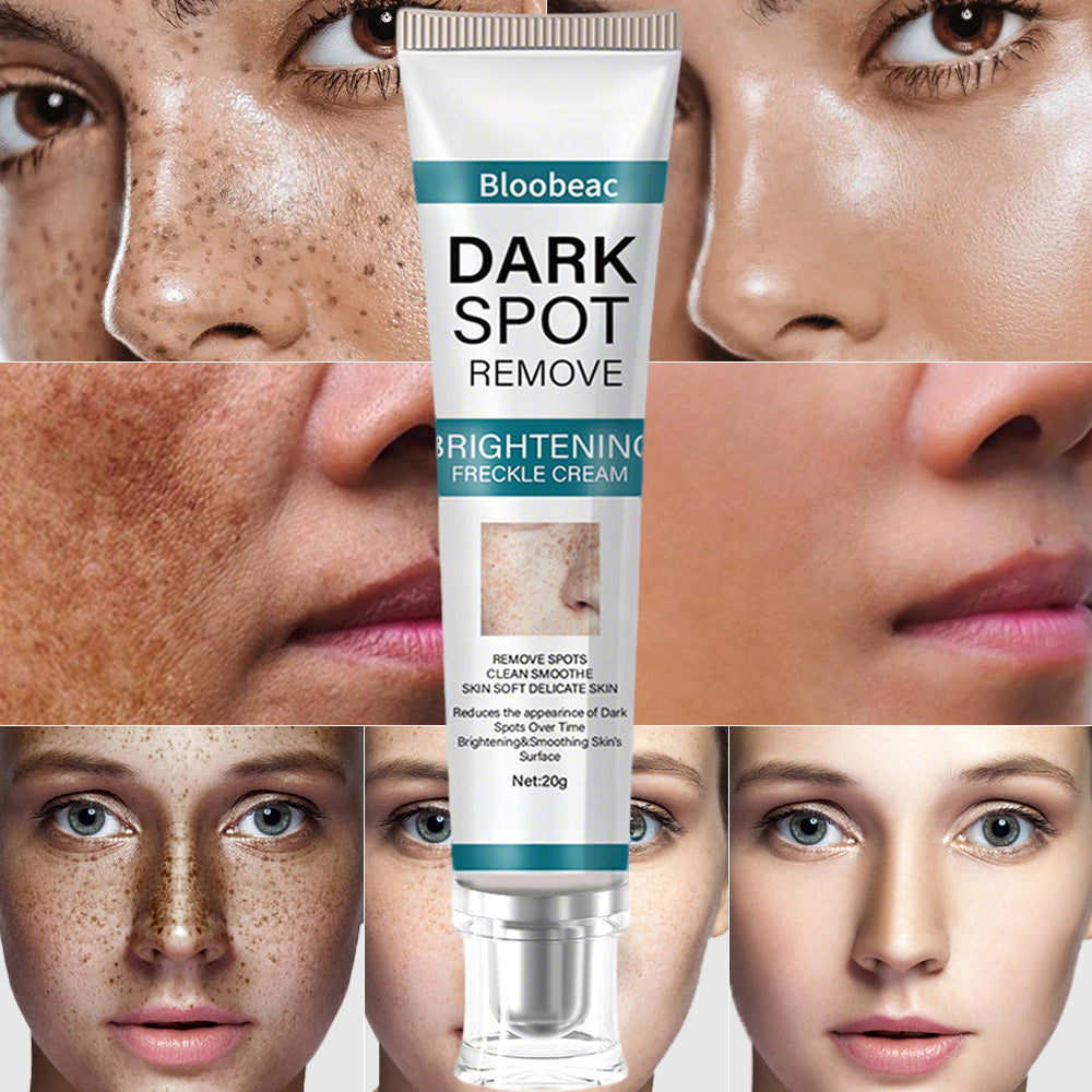 AuraRenew Blemish Cream - Erase Spots & Wrinkles - 50% OFF