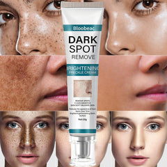 AuraRenew Blemish Cream - Erase Spots & Wrinkles - 50% OFF