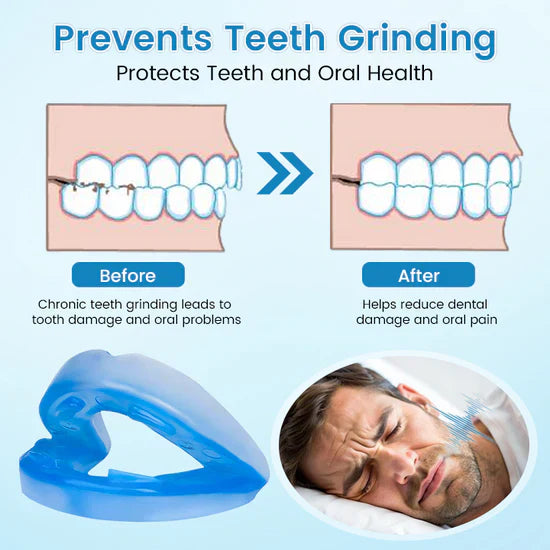 The SilentNight Protector - End Snoring & Teeth Grinding + LAST DAY SALE 50% OFF