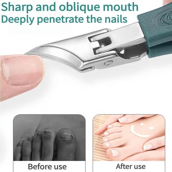PrecisionGrip Pro - Effortless Ingrown Nail & Thick Nail Solution - 50% OFF
