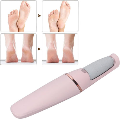 SoleSmooth Pro – The Ultimate Foot Care Solution for Silky Smooth Feet - 50% OFF