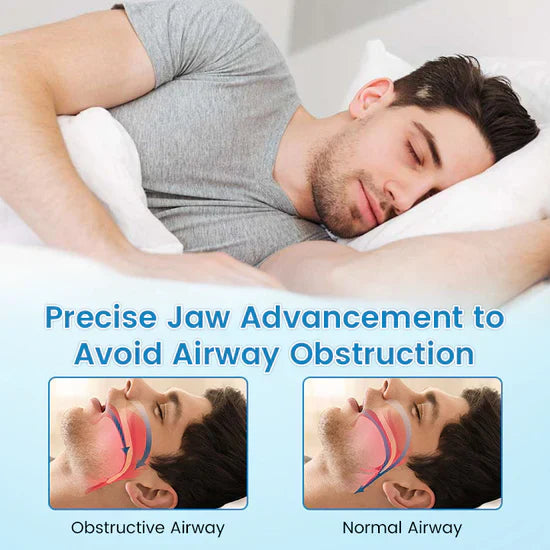 The SilentNight Protector - End Snoring & Teeth Grinding + LAST DAY SALE 50% OFF