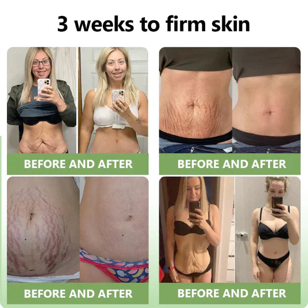 OmniCreme - The Only Skincare You Need - 50% OFF