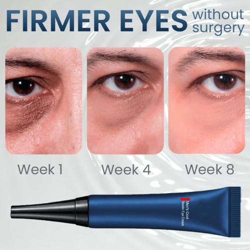 RadiantEyes Firming Eye Gel – Achieve Brighter, Firmer, Youthful-Looking Eyes - 1+1 FREE