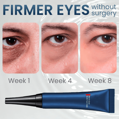 RadiantEyes Firming Eye Gel – Achieve Brighter, Firmer, Youthful-Looking Eyes - 1+1 FREE