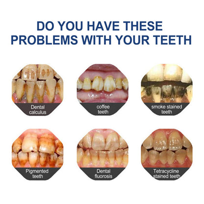 BBOJI™ Hydroxyapatite Toothpaste - Rebuild Enamel, End Sensitivity + 50% OFF