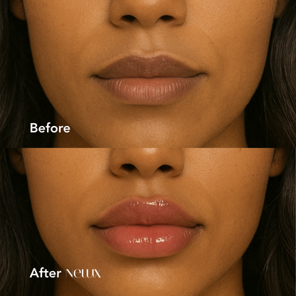 The Hyaluronic Lip Plumper - Plump Without the Pain + 1+1 FREE