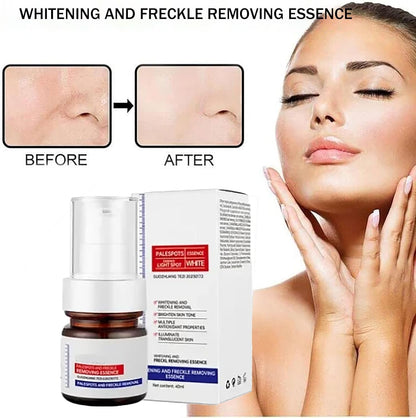 Vitamin C Whitening Freckles Face Cream (Radiant Renew) – Achieve Clear, Radiant, Even-Toned Skin- 50% OFF
