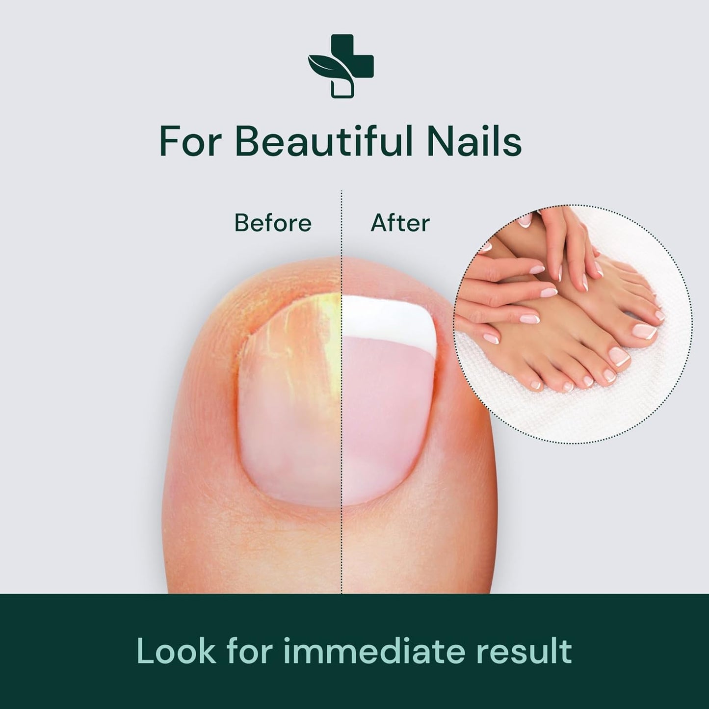 NailRevive – The Ultimate Nail Transformation Serum - 1+1 FREE