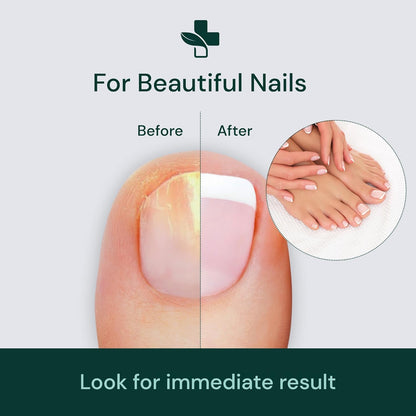 NailRevive – The Ultimate Nail Transformation Serum - 1+1 FREE