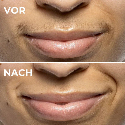 DermaSmooth Crème - Silky-Smooth Skin, Zero Pain - 50% OFF