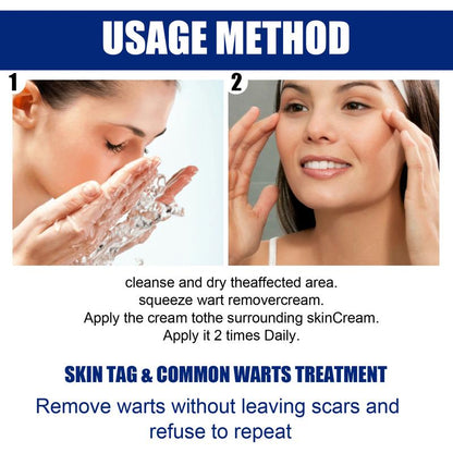 DermaClear Wart Ointment - Your Permanent Skin Solution - 50% OFF