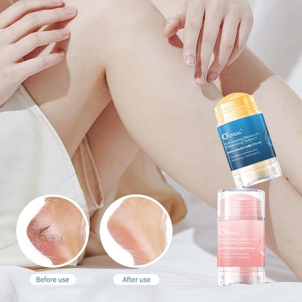 RejuvaSole Balm + Instantly Transform Dry, Cracked Feet into Soft, Supple Perfection - 50% OFF
