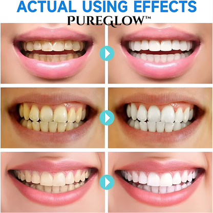 The AuraGlow Whitening Gel - Niacinamide Brightening, Enamel Repair, and Day Results + 50% OFF