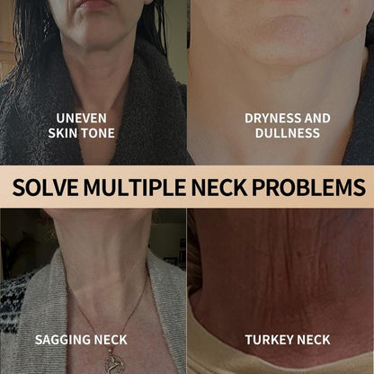 NeckRenew – Rediscover Your Youthful Neckline - 60% OFF
