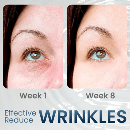 RadiantEyes Firming Eye Gel – Achieve Brighter, Firmer, Youthful-Looking Eyes - 1+1 FREE