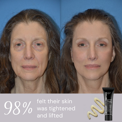 Ageless Aura Instant Lift + Erase Years in Seconds, Reveal a Timeless, Vibrant Gaze - 50% OFF