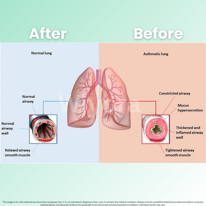 AirNova 2.0 - Breathe Easy, Anywhere + 50% OFF