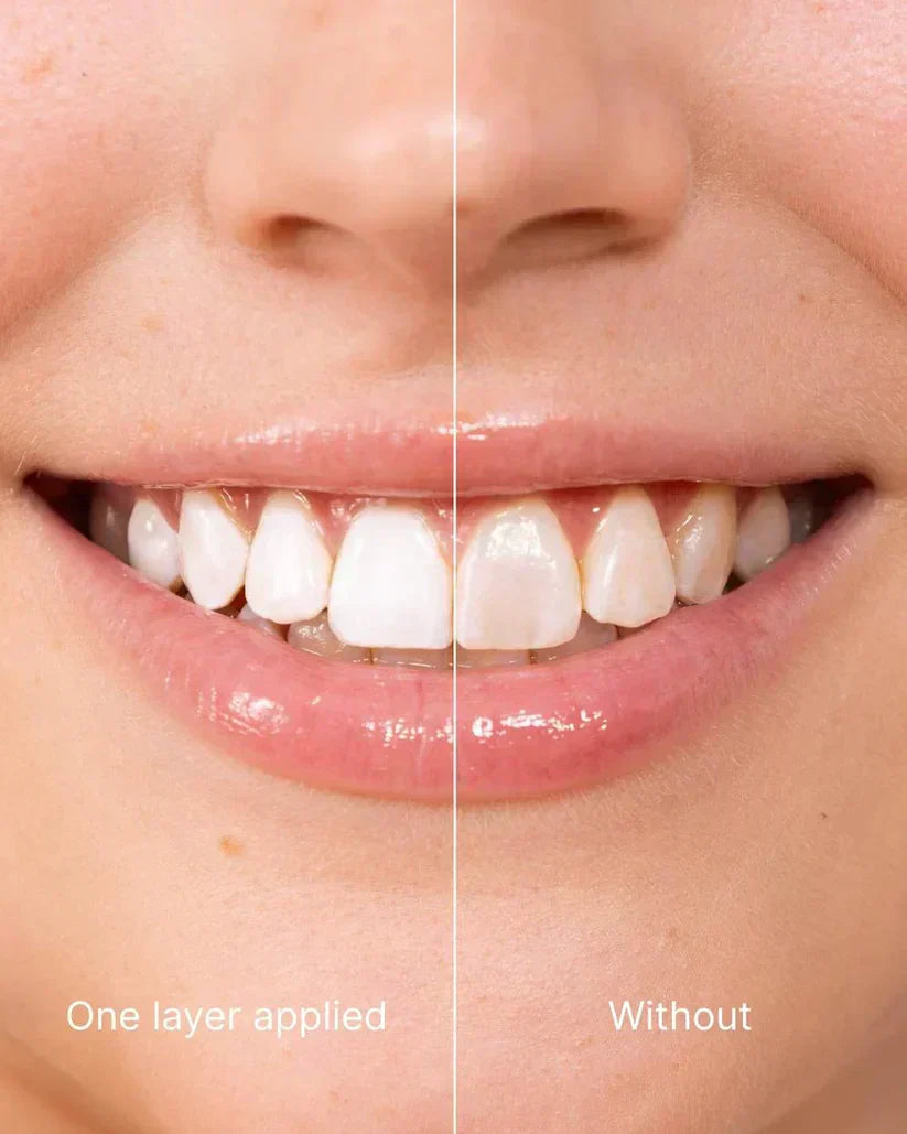 LumiSmile — Achieve Professional Whiteness Instantly + 50% OFF
