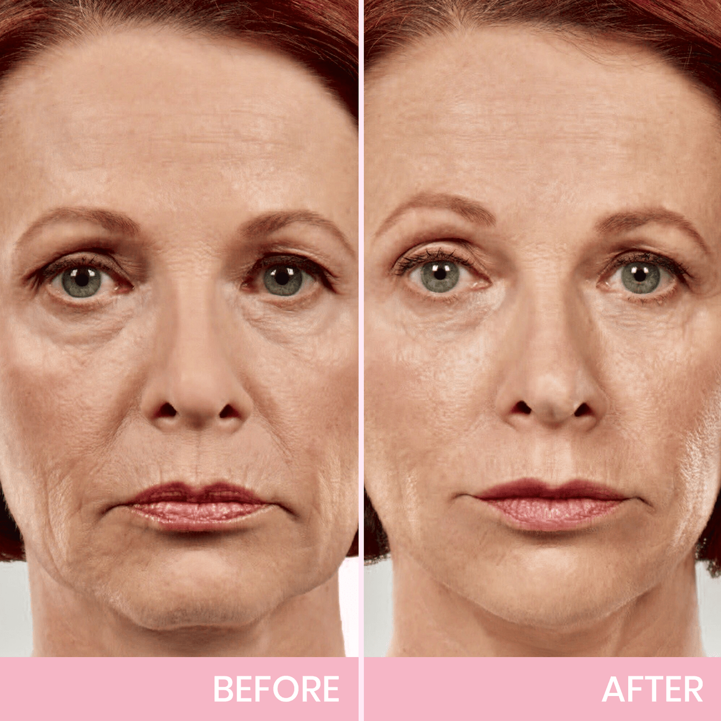1 + 1 FREE - Instant V-Lift Tape – Lift Years Off Instantly!