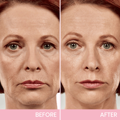 1 + 1 FREE - Instant V-Lift Tape – Lift Years Off Instantly!