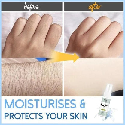 SmoothGlide – Effortless Hair Removal for Silky-Smooth Skin - 50% OFF
