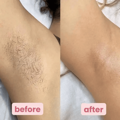 The PetalSmooth Shave Pro - A Perfect Shave, No Razor Burn + 50% OFF