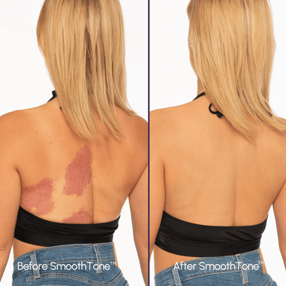 DermaBlend Perfector – Your Flawless Skin Canvas - 50% OFF