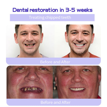 BBOJI™ Hydroxyapatite Toothpaste - Rebuild Enamel, End Sensitivity + 50% OFF