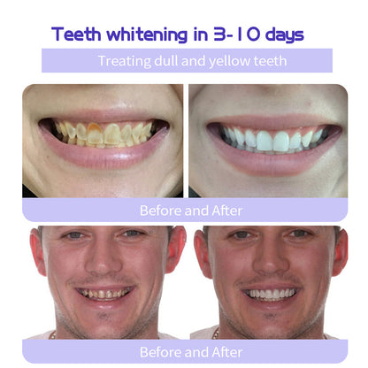 BBOJI™ Hydroxyapatite Toothpaste - Rebuild Enamel, End Sensitivity + 50% OFF