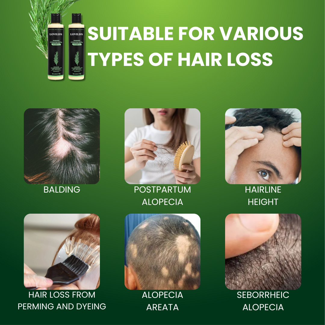 LOVILDS Rosemary Keratin – Grow Thicker, Fuller Hair – 50% OFF