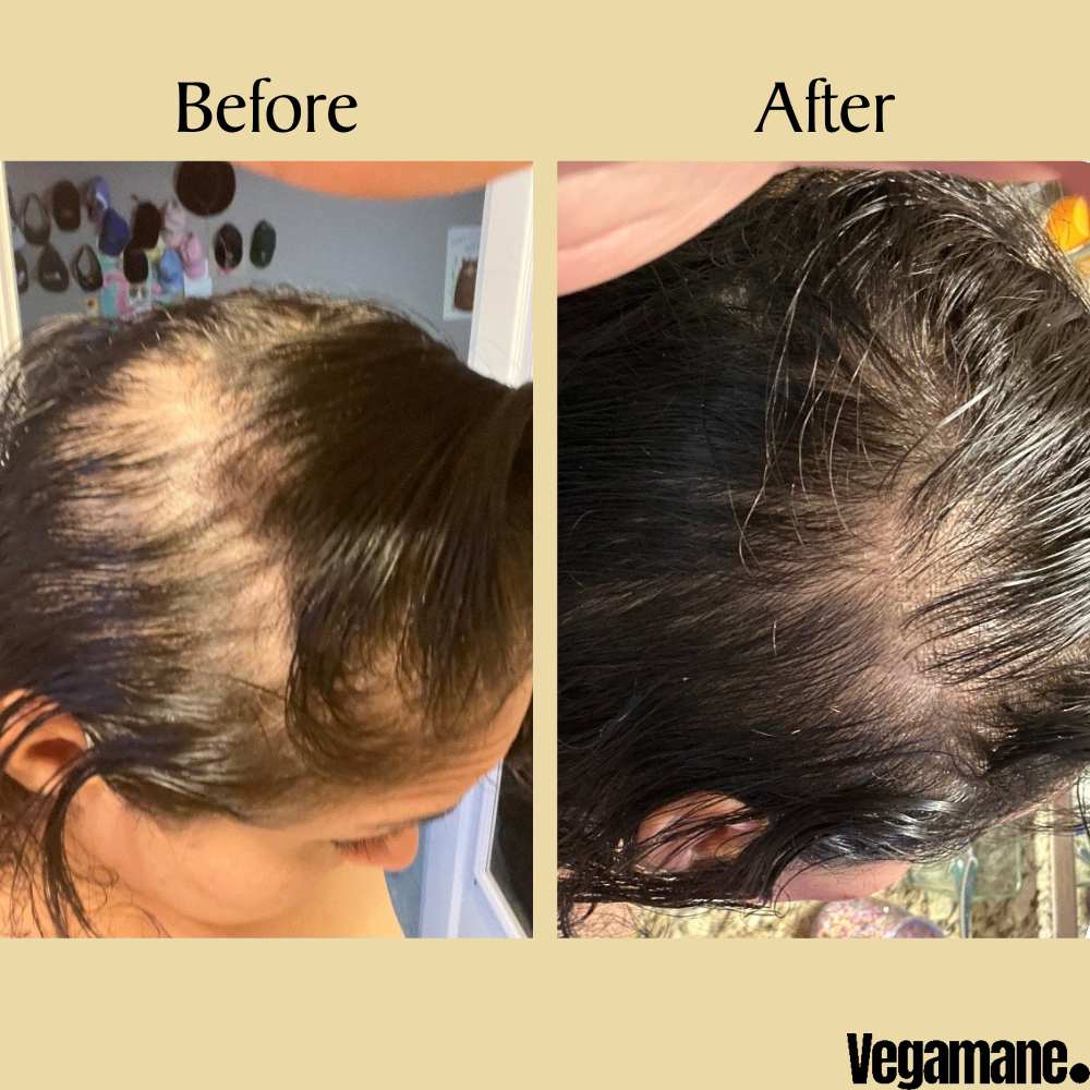 FolliRoot – Regrow thicker, fuller hair. + 50% OFF
