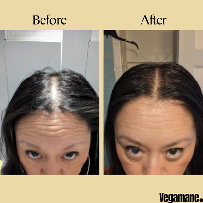 FolliRoot – Regrow thicker, fuller hair. + 50% OFF