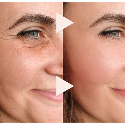 Wrinkle Eraser – An Instant Lift in a Stick + 50% OFF