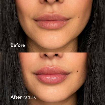 The Hyaluronic Lip Plumper - Plump Without the Pain + 1+1 FREE