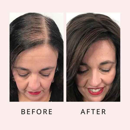 RootRenew Elixir - Reclaim Your Hair's Fullness - 50% OFF