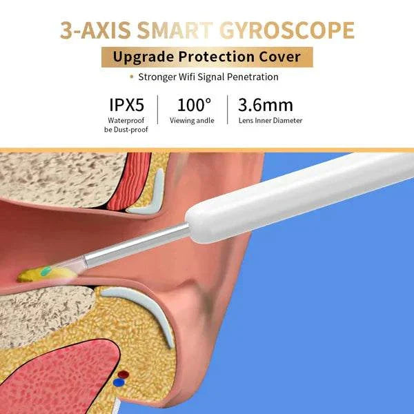OtoScope HD - Clean Your Ears Safely, See Everything - 50% OFF