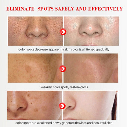 AuraRenew Blemish Cream - Erase Spots & Wrinkles - 50% OFF