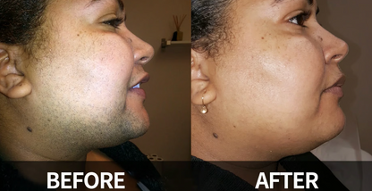 DermaSmooth Radiance-  Reveal Your Flawlessly Smooth, Confident Glow 1 + 1 FREE