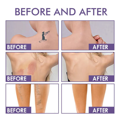 DermaVeil Body Perfector - Flawless Legs, Instantly - 50% OFF