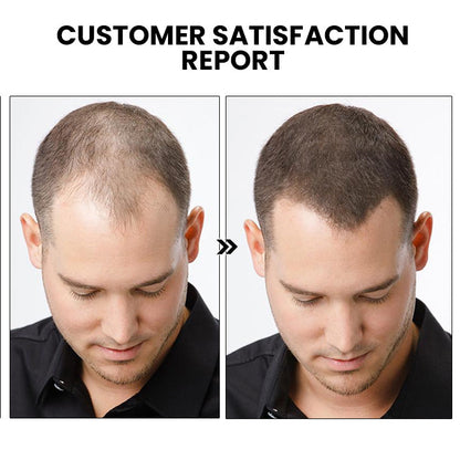 HairRevive – Unlock Your Hair’s Full Potential - 1+1 FREE