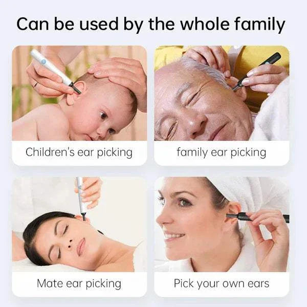 OtoScope HD - Clean Your Ears Safely, See Everything - 50% OFF
