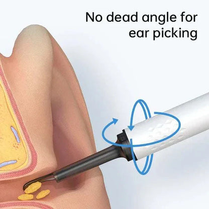 OtoScope HD - Clean Your Ears Safely, See Everything - 50% OFF