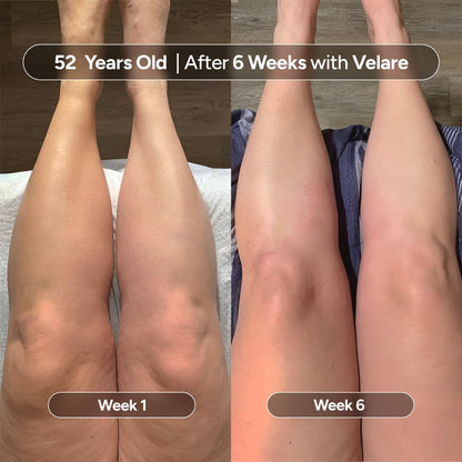 Velare Oil - Rebuild Smooth, Firm Skin -  50% OFF TODAY