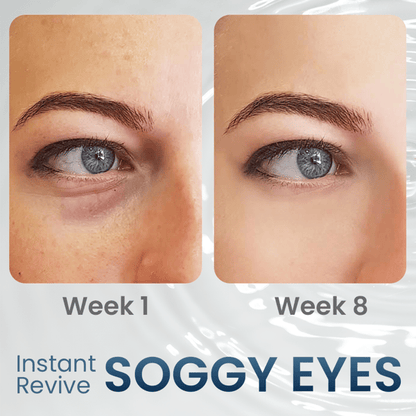 RadiantEyes Firming Eye Gel – Achieve Brighter, Firmer, Youthful-Looking Eyes - 1+1 FREE